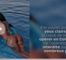 Elle a voulu faire changer la couleur de ses yeux, aujourd’hui elle est presque aveugle !
