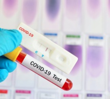 Covid 19:Le ministère de la Santé arrête les tests sur les cas contacts...