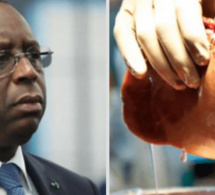 Transplantation rénale au Sénégal: Les grosses craintes du Président Macky Sall!