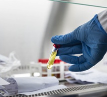 Futur vaccin contre le coronavirus: Les pays africains veulent au moins 220 millions de doses
