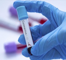 Covid-19 - Nouveaux symptômes, comment le virus a muté