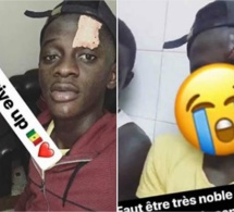 Jaaw Ketchup revient sur son agression et confie « Abba dou nitou dara…