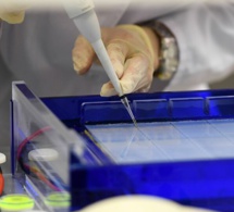 Un nouvel effet dangereux du coronavirus chez les patients adultes mis en lumière par des scientifiques
