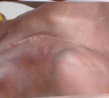 Appel à la solidarité : Face à une urgence médicale l’assistance des bonnes volontés très attendue