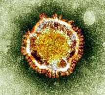 Des chercheurs identifient des vulnérabilités communes à trois coronavirus mortels