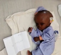 Appel à la solidarité : leur bébé souffrant d’hydrocéphalie dans l'attente d'une opération, une famille sollicite un soutien d’urgence