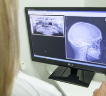 Un médecin met en garde contre cette conséquence dangereuse des migraines