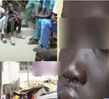 Maladie mystérieuse: Abdou Karim Sall soupçonne qu'elle soit d’origine algale