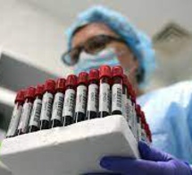 Les tests conjoints entre AstraZeneca et le centre russe Gamaleïa sur leurs vaccins commenceront bientôt