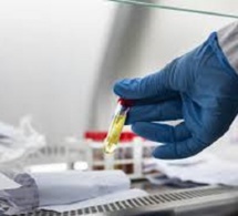 Lutte contre les maladies tropicales négligées à Ziguinchor : des suspicions sur la COVID-19 perturbe la campagne
