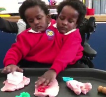 Les jumelles siamoises Marième et Ndèye font leur entrée à l'école, à Cardiff