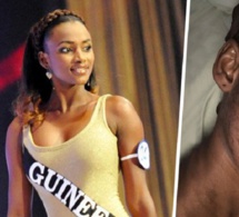 Victime d’une réaction allergique causée par des produits de beauté, la Miss Cedeao 2012 méconnaissable (Photos)