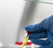 Covid-19: Le prix des tests rapides divisé par deux pour les pays en développement