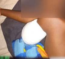Manifestations de soutien à Ousmane Sonko : l’élève amputé du bras est sorti de l’hôpital