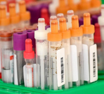 L'Agence européenne des médicaments publie des recommandations sur le traitement du Covid-19
