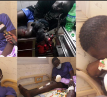 Cueilli par la Sûreté urbaine à sa sortie d’hôpital: Cheikh Diouf était sous le coup d’un mandat d’arrêt