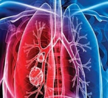 Autre danger pour la santé publique : pourtant la tuberculose continue de tuer au Sénégal