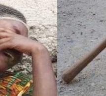 Mbacké: A cause d’une somme de 8000f, il assomme sa mère d’un coup de pilon