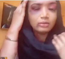 Après avoir agressé sa voisine: Sirakha Sima fait le fou pour éviter la prison