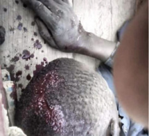 Affrontements à Ndingler : Des blessés entre paysans et sécurité de Babacar Ngom enregistrés