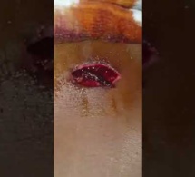 Bandia: Une sage femme échappe au viol, mais...(Images choquantes, âmes sensibles s'abstenir)