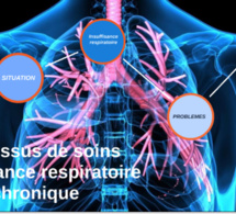 Covid-19 / Insuffisance respiratoire chronique: Ces personnes atteintes, invitées à se faire vacciner