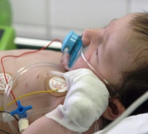 Les cas de bronchiolite en hausse: quels symptômes doivent alerter chez l'enfant?