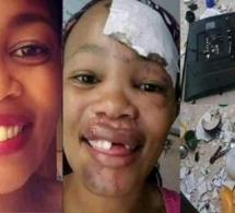 Un homme arrache les dents de sa petite amie avec une pince, pour avoir détruit ses biens