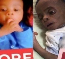 Triste ! Mort d’un bébé de 5 mois qui aurait été affamé par la patronne de sa mère