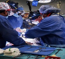 Le cœur d’un porc transplanté chez un Américain lors d’une chirurgie révolutionnaire
