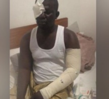 Violences politique : Un partisan de Serigne Mboup attaqué à Médina Baye