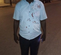 Agression d'Ousmane Coly: Abdou Sané de Pastef /Ziguinchor accuse le camp de Baldé