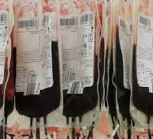 Santé-Pénurie de sang à l’hôpital Thiès : Une maladie chronique