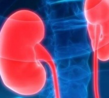 Insuffisance rénale / Sédhiou : 20 à 30 patients consultés mensuellement