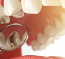 Santé bucco-dentaire : "Combattre les affections bucco-dentaires dans le cadre de la lutte contre les maladies non transmissibles" (OMS)