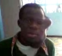 Vidéo - Après une bagarre, Abdoulaye Djimbira se retrouve avec un visage défiguré et un cou boursouflé