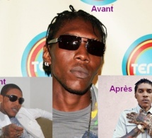 Prison à perpétuité : Risque de devenir noir, la digmentation de Vybz Kartel menacée, il s'inquiéte! !