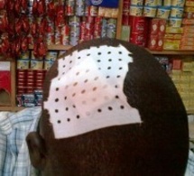 Mbeuleukhé (Linguère) : un boutiquier agressé dans une tentative de braquage