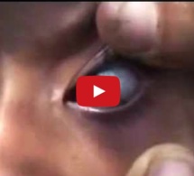 Une jeune fille Yéménite pleure des larmes de pierre (Vidéo)