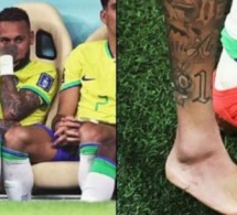 Le médecin de la sélection brésilienne annonce la nature de la blessure de Neymar