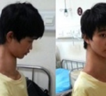 Le '’garçon girafe’', un jeune Chinois au cou anormalement long