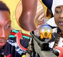 Blessé lors des manifestations, un militant de Pastef explose : « Maimouna Dieye nous a trahis ! »