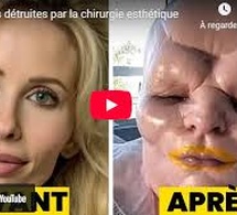 Chirurgie esthétique : 8 femmes victimes de dérives graves