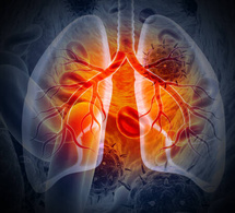 Ziguinchor : 420 cas de tuberculose en six mois, l’alerte est donnée