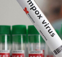Mpox au Sénégal : Le seul patient recensé est totalement guéri, plus de cas actif de Mpox, vigilance maintenue par le ministère