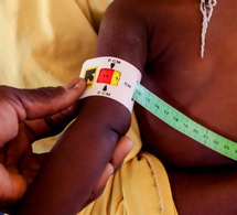 La malnutrition provoque une forme distincte de diabète, concluent des experts mondiaux