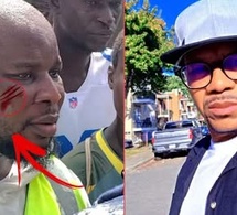 Bagare entre le maire et une journaliste l'activiste Omzo démolit le gangstérisme de Bilal Diatta..