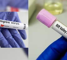 Épidémies : 78 cas de Fièvre de la Vallée du Rift et 5 cas de Mpox recensés à la date du 3 octobre 2025