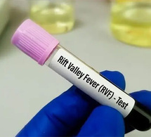 Mpox et Fièvre de la Vallée du Rift : Thiès enregistre son premier cas , 302 cas confirmés au Sénégal