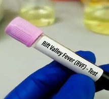 FVR et Mpox : 5 nouveaux cas et 1 décès : La situation sanitaire sous surveillance au Sénégal, le ministère renforce l'alerte sanitaire